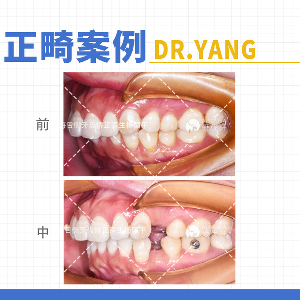 平导原理示意图图片