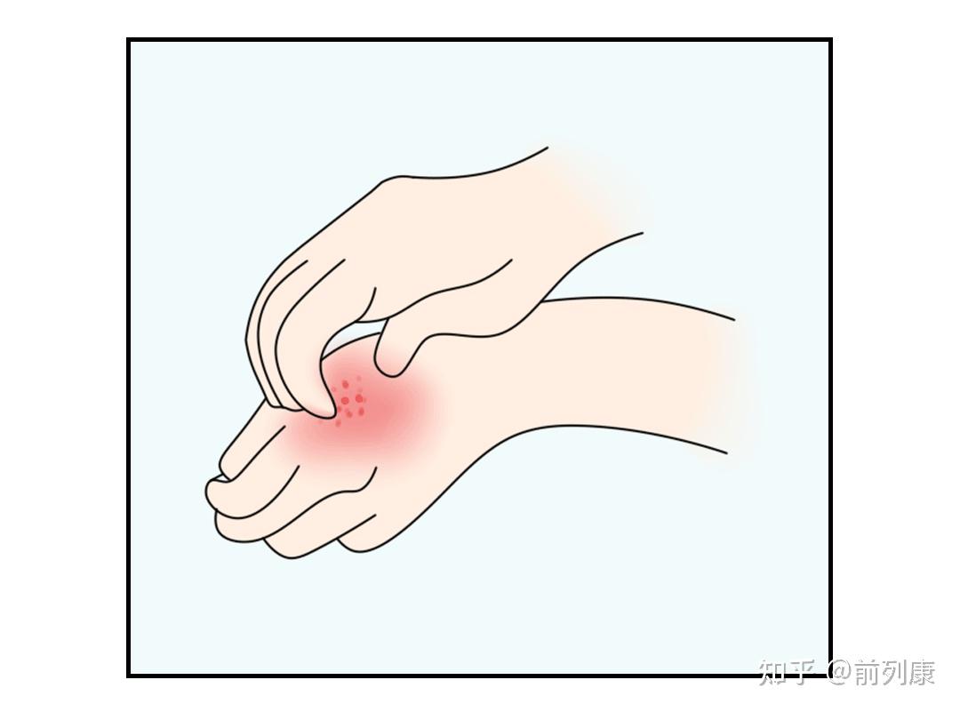 男人下面瘙痒,是性病吗?