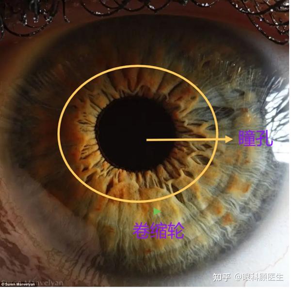 虹膜的真实面目 知乎