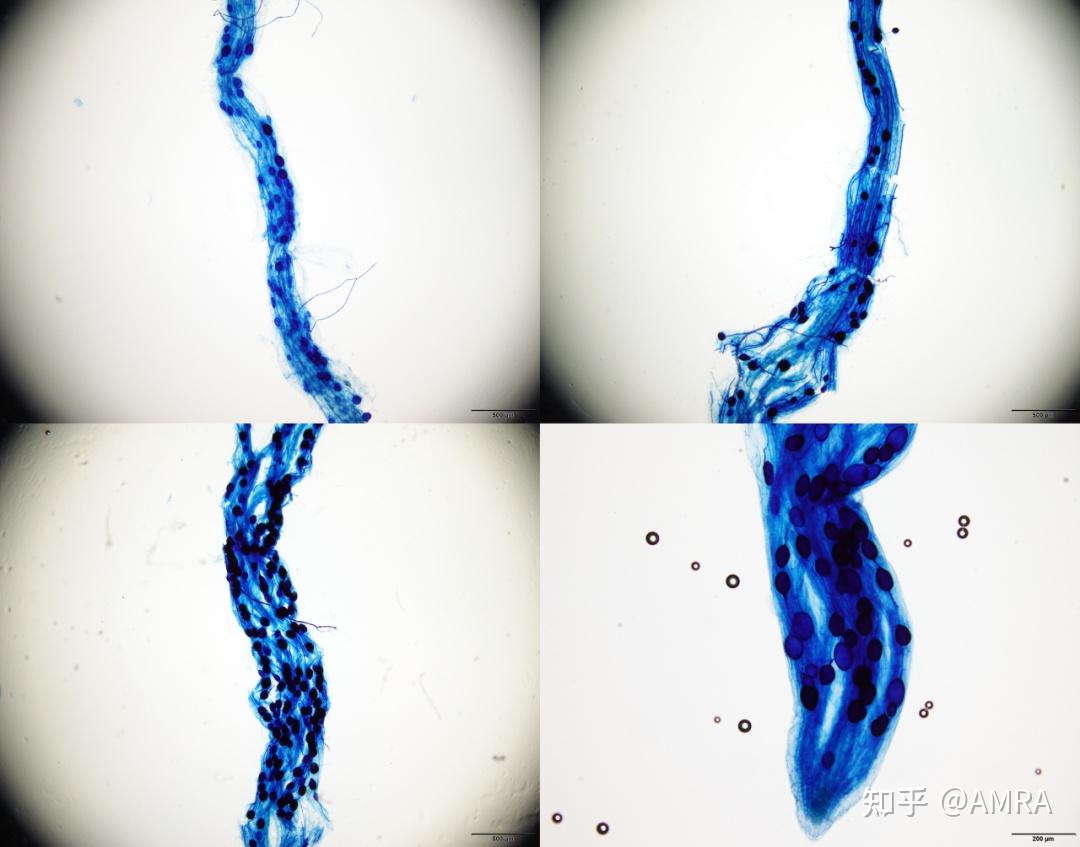 丛枝菌根显微镜图片