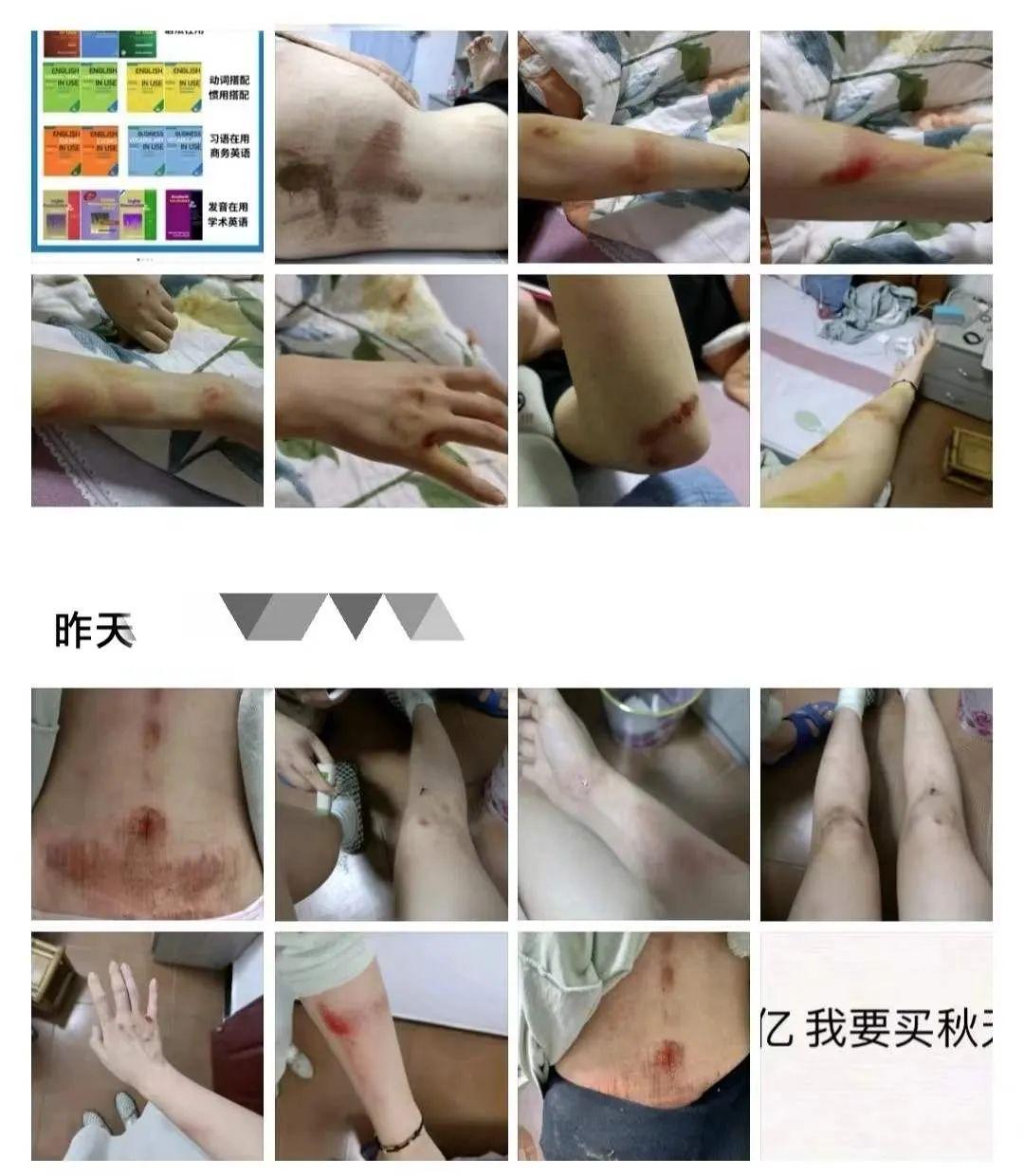 12岁小学生 21岁的我，被12岁小学生拖到草丛猥亵” - 知乎