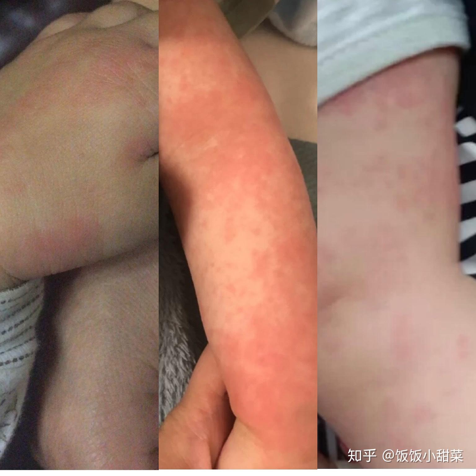 我婆婆本身有一点迷信思想,觉得我们是不是染上了什么不干净的东西,是