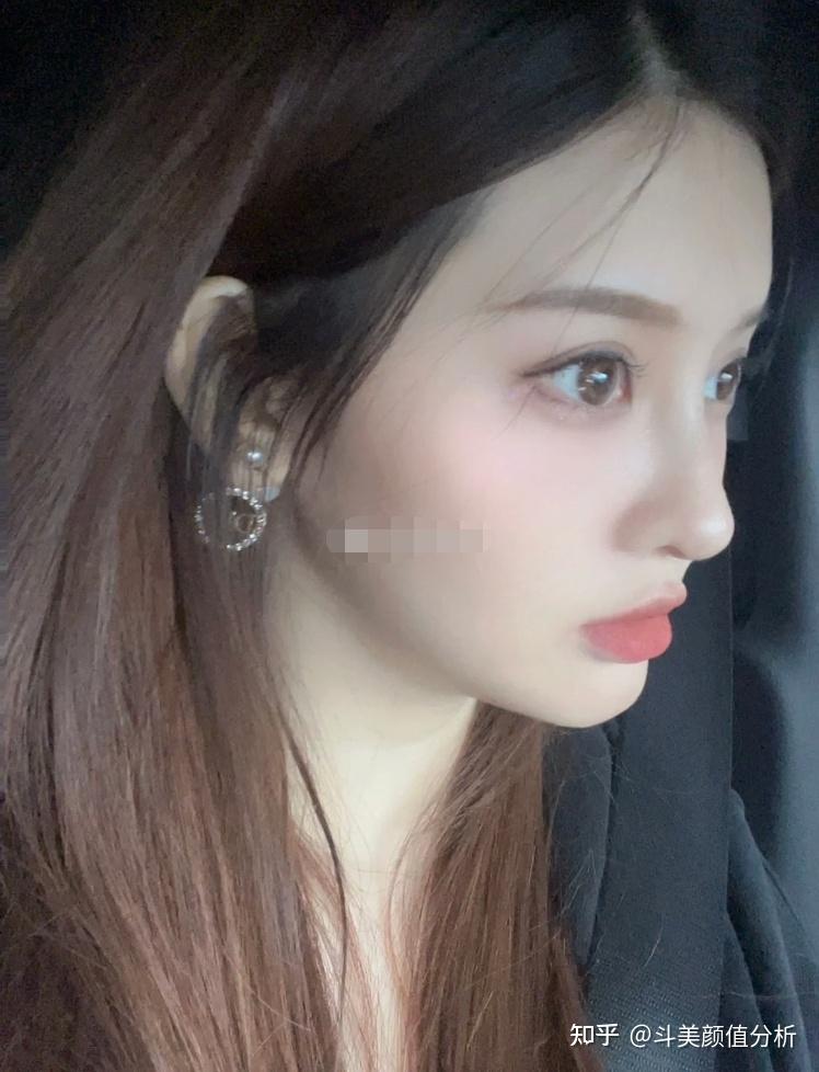 广州有没有做隆鼻自然?