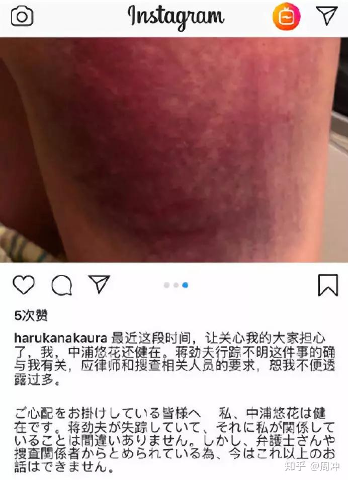 蒋劲夫女友被打流产但又有爆料称她假孕骗钱真相到底是什么