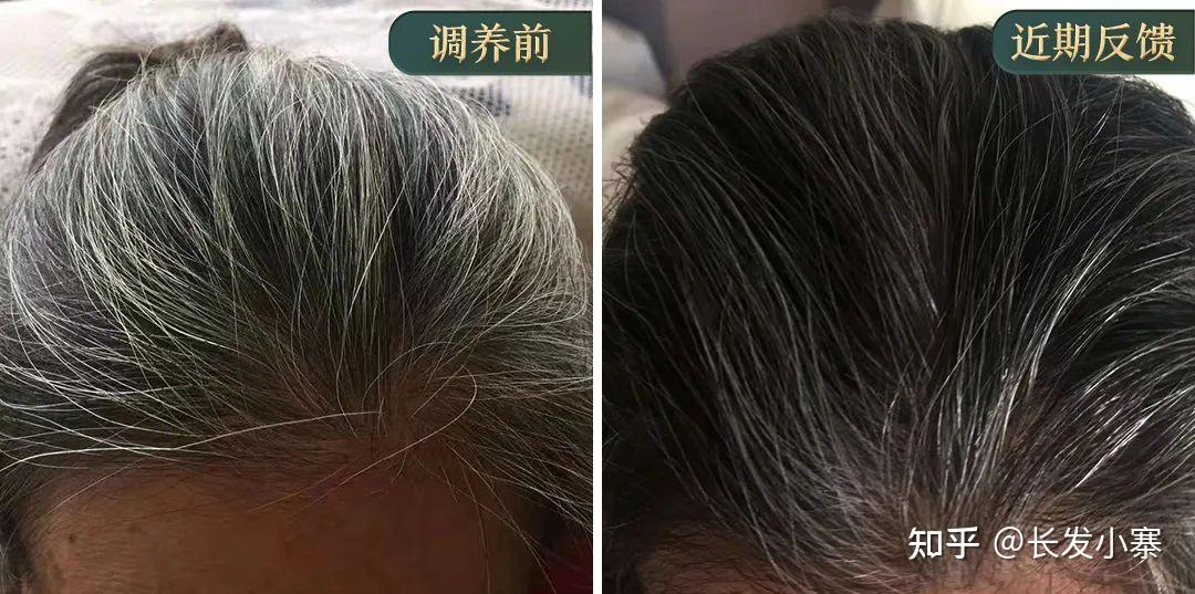 长发小寨给您扒一扒黑发的科学,白发多久才能转黑? - 知乎