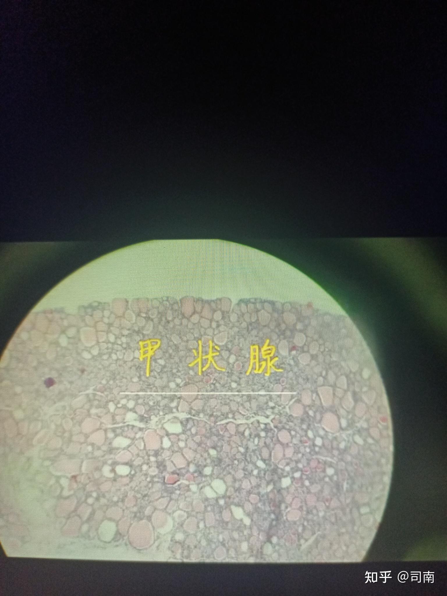 甲状腺c细胞图片