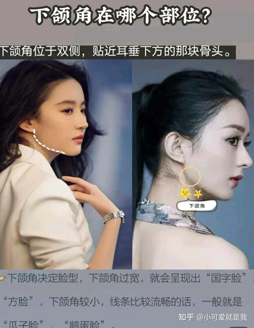 何晋龙解读下颌角如何做才不会下垂