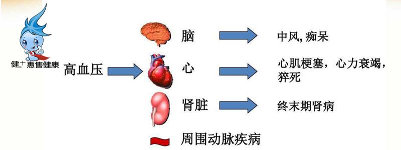 健十详谈高血压的并发症有哪些 - 知乎