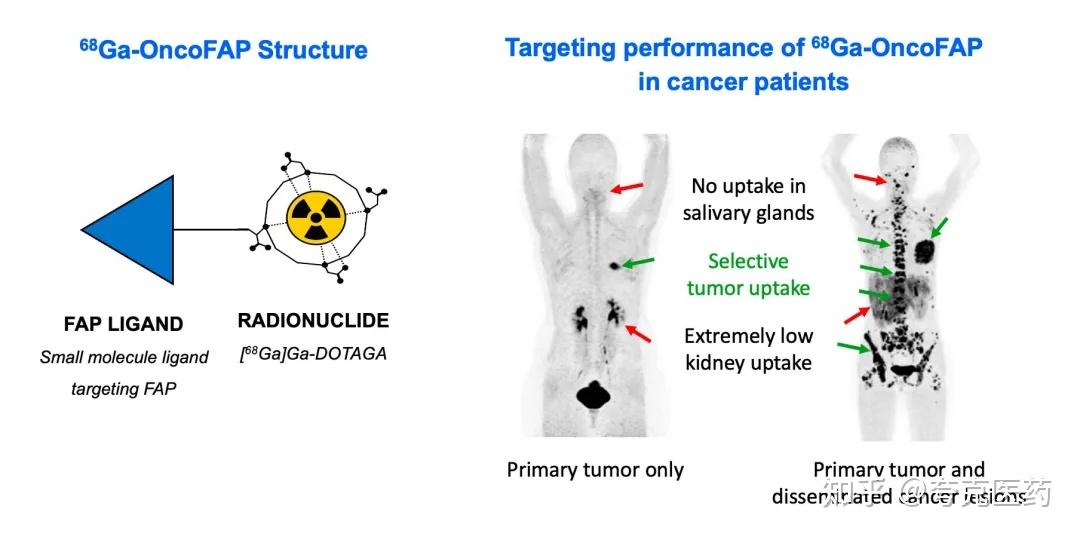 ESMO 2025：PSMA靶向药物前线突破与下一代技术方向 - 知乎