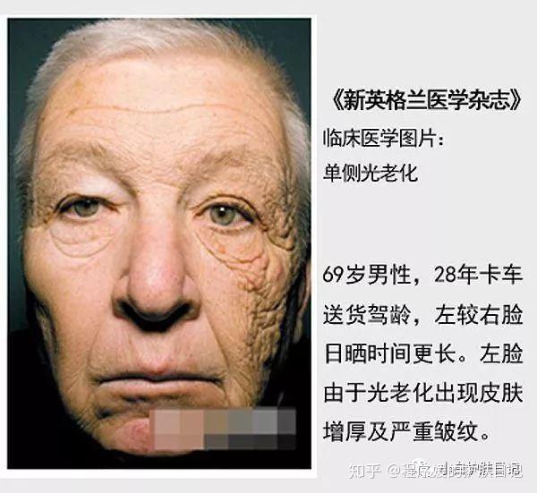 皮肤衰老的秘密 - 知乎
