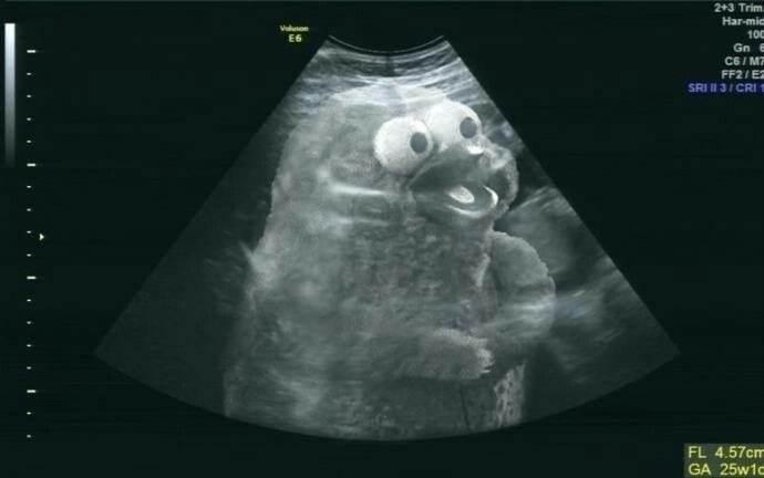 怀孕x光照片搞笑图片