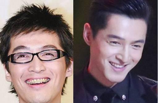 盘点娱乐圈整过牙齿的明星