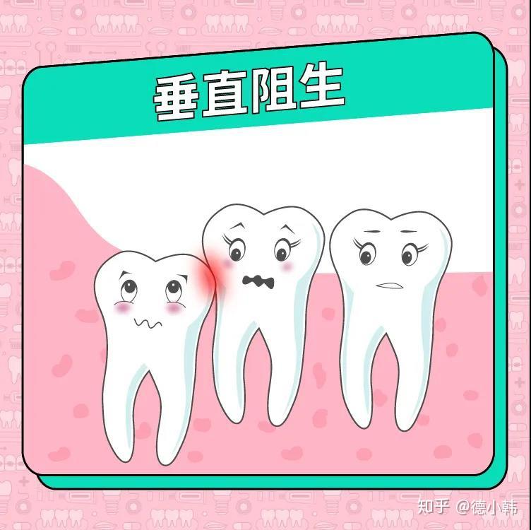 v2-3cd9bbd63be4cb961c69ea6e18ffb62b_r.jpg