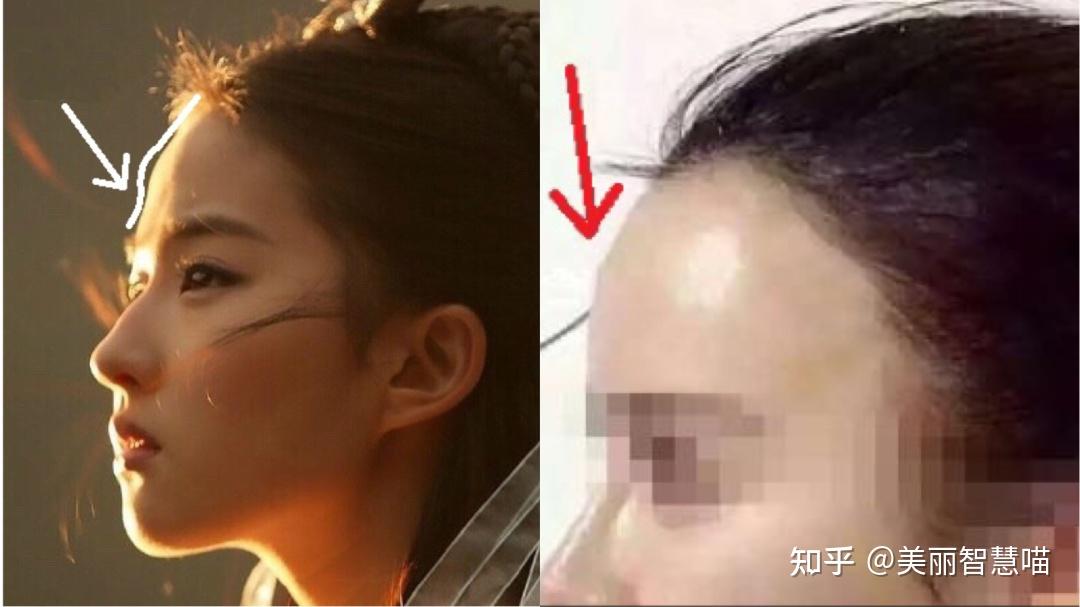 干货填充后塑料感陡增竟是因为这个不起眼的部位