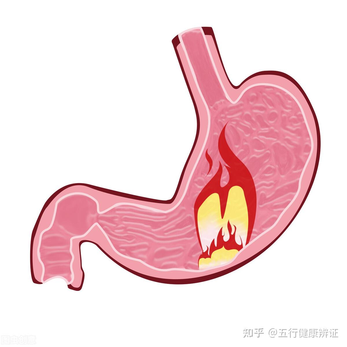 口苦胃脹反酸胃疼肝胃不和中醫教你如何調理