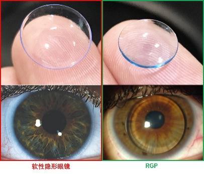 高度近视还在戴框架眼镜?rgp隐形眼镜了解一下