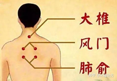 临床医案:伤湿止痛膏贴敷治疗顽固性咳嗽