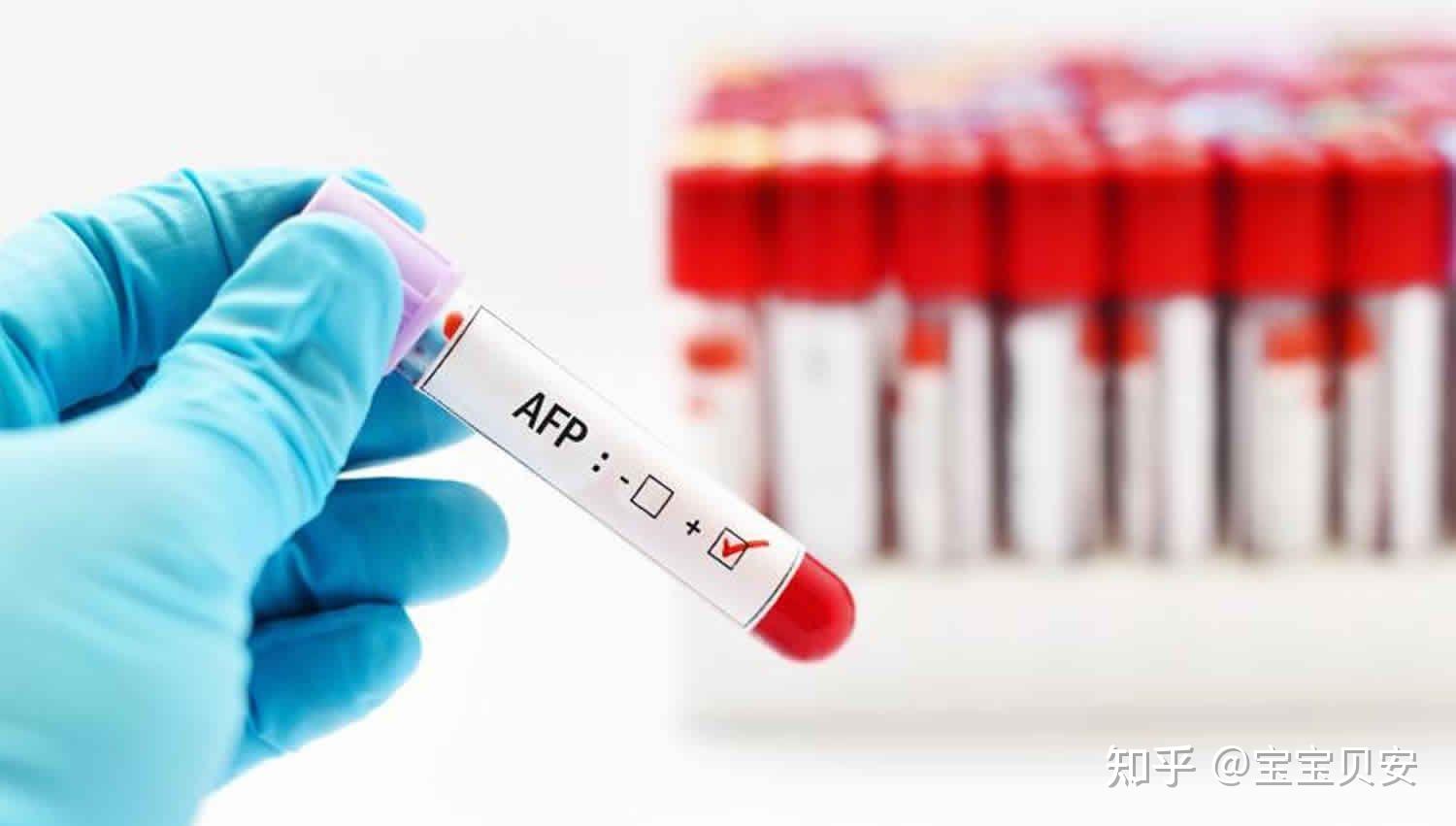 甲胎蛋白偏高是为什么呢