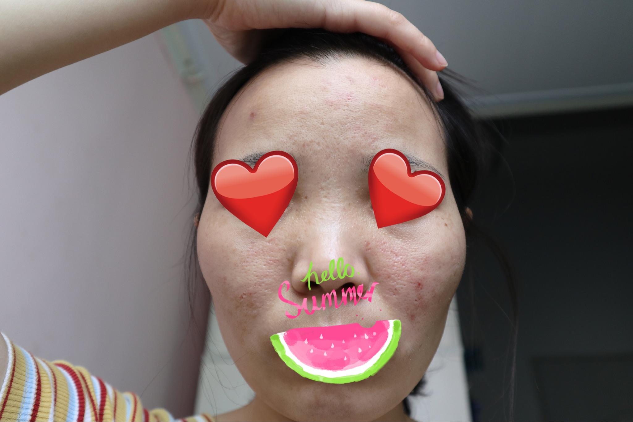 v2-3e3ebb5472461470436bf4ac6b9a91d3_r.jpg