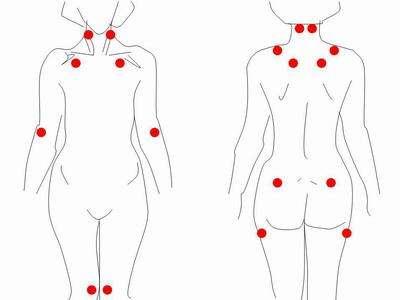 全身上下肌肉疼痛当心纤维肌痛综合症