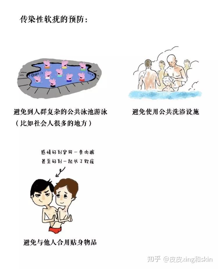 皮医生画画了——带你鉴别皮肤病 - 知乎