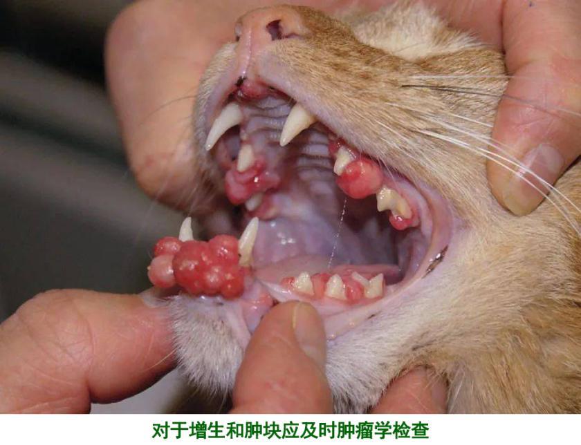 增多伴随核左移,单核细胞增加,轻度淋巴细胞减少和嗜酸性粒细胞增多