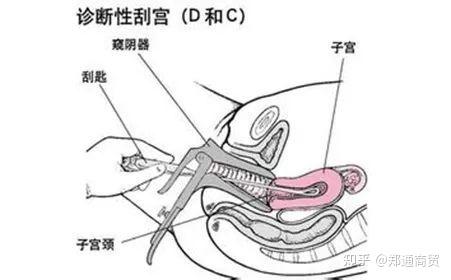 女性手术危害图片