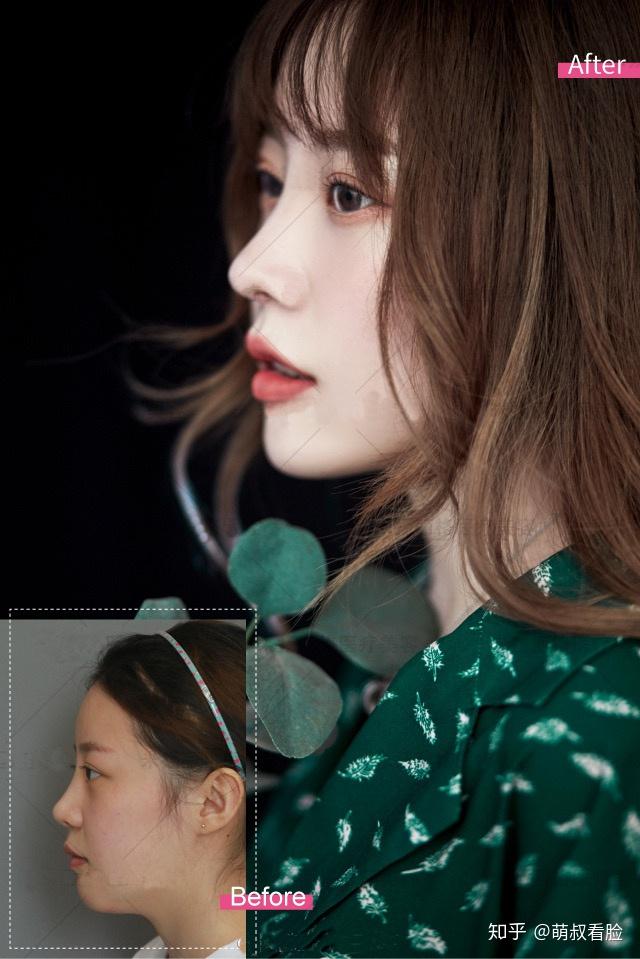 v2-3f28ecbcc18e4d5fef0117d0d870fac7_r.jpg