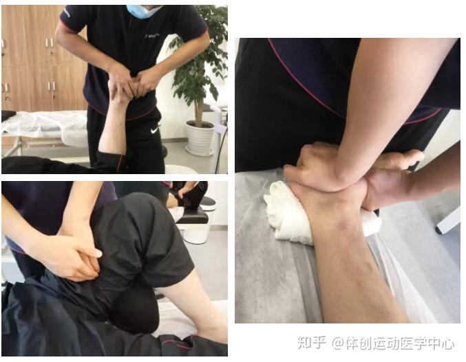 扁平足膝外翻髌腱炎都是脚踝韧带撕裂惹的祸看看姚同学如何回归赛场