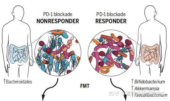 菌群移植费用 - 知乎
