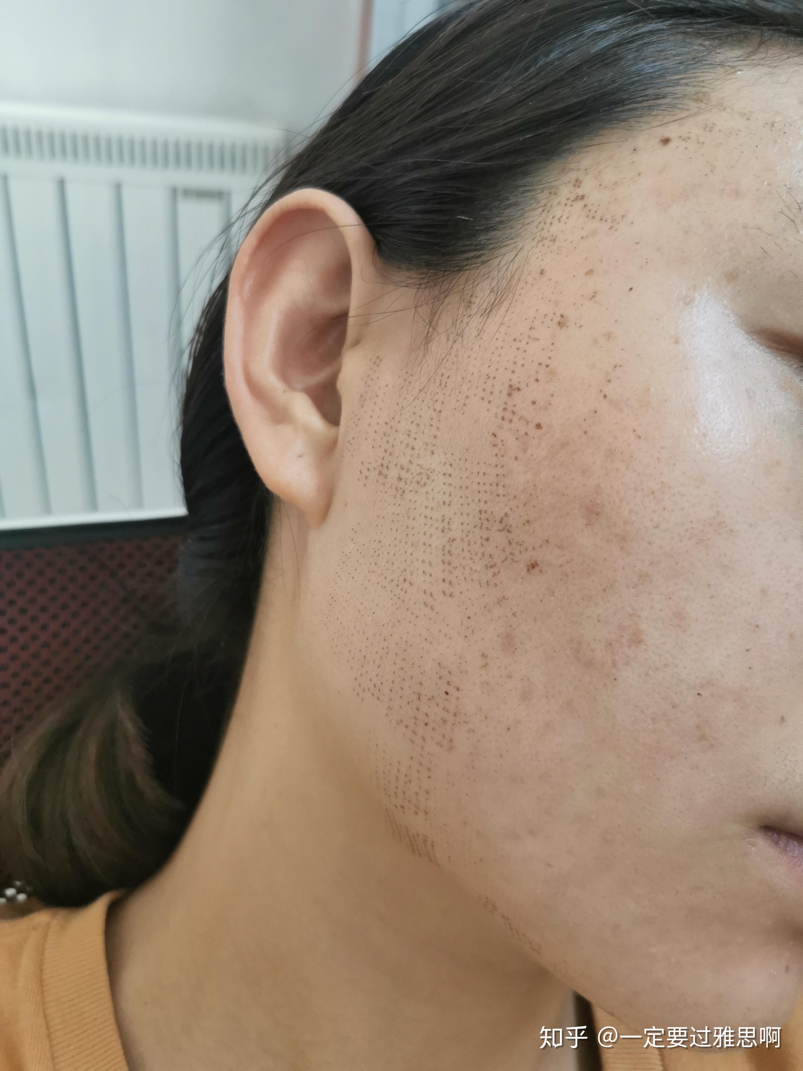 点阵激光实记