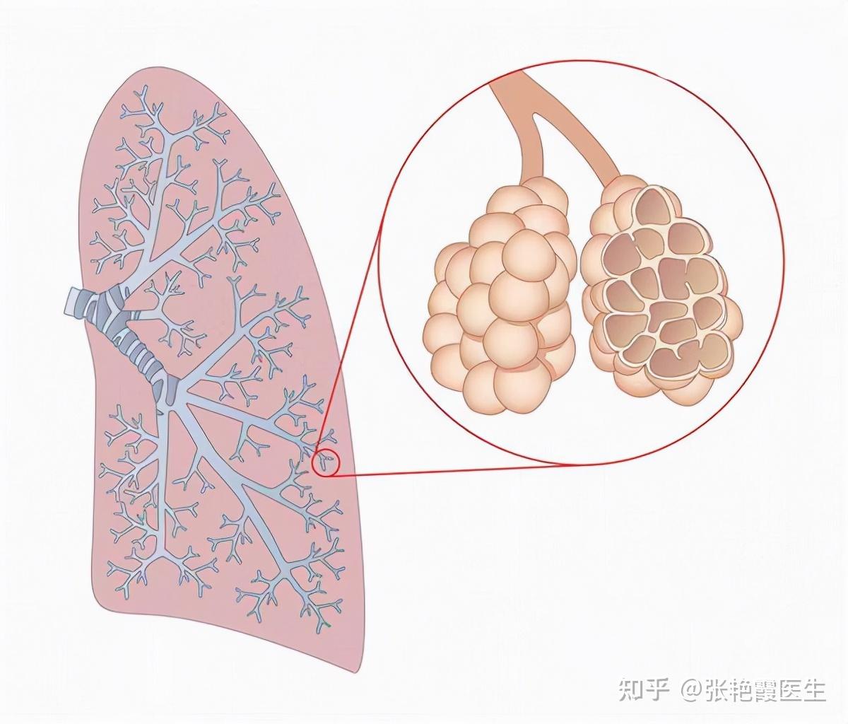 5年肺氣腫如何擺脫咳痰喘和胸悶氣短呼吸困難說拜拜