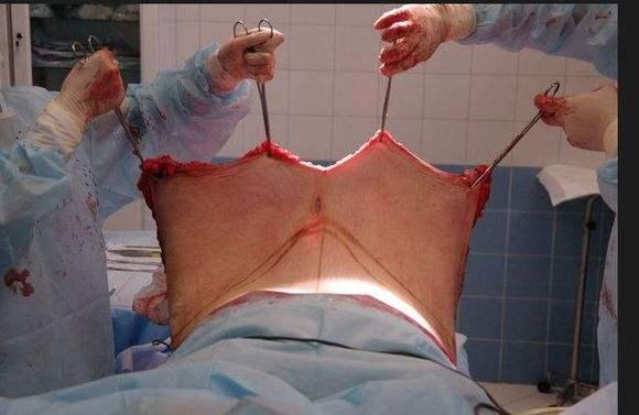 最快减肥方法排名表