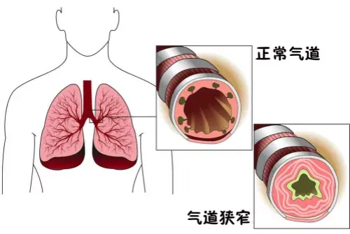 没动两下就气喘吁吁单纯的运动不足吗