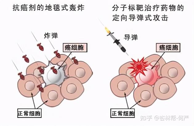 腺泡狀軟組織肉瘤知多少