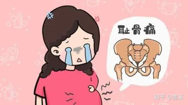 石家庄产后修复——产后耻骨分离真的是痛到怀疑人生