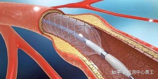 医用高分子材料的种类及市场前景 - 知乎
