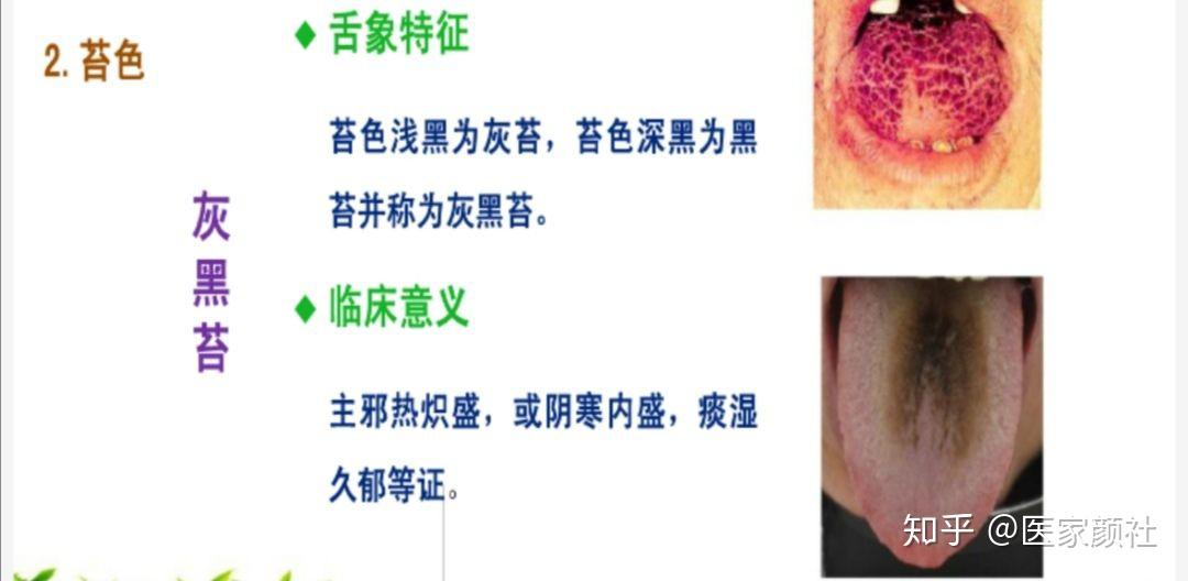 如何通过舌苔来判断身体健康与否?最全舌像来了,一分钟教你学会所有舌像! - 知乎