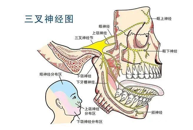 什么是三叉神经痛?