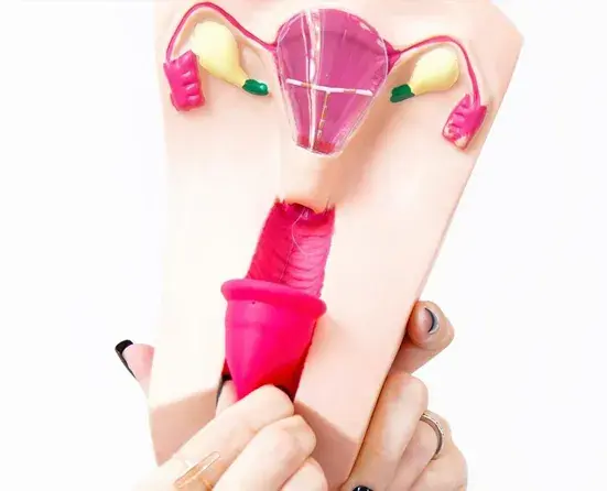 残害一代中国女性的节育环今日我想为它说上几句公道话