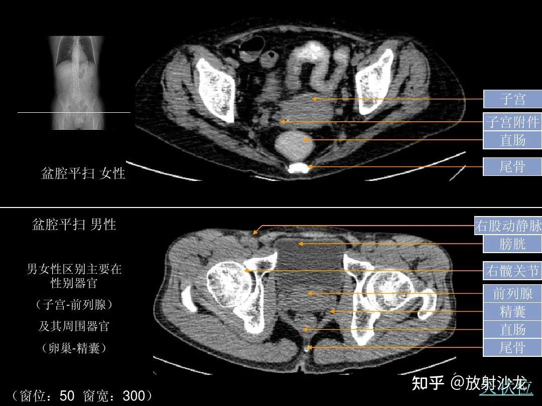 超细的腹部CT入门精美解剖图谱 - 知乎