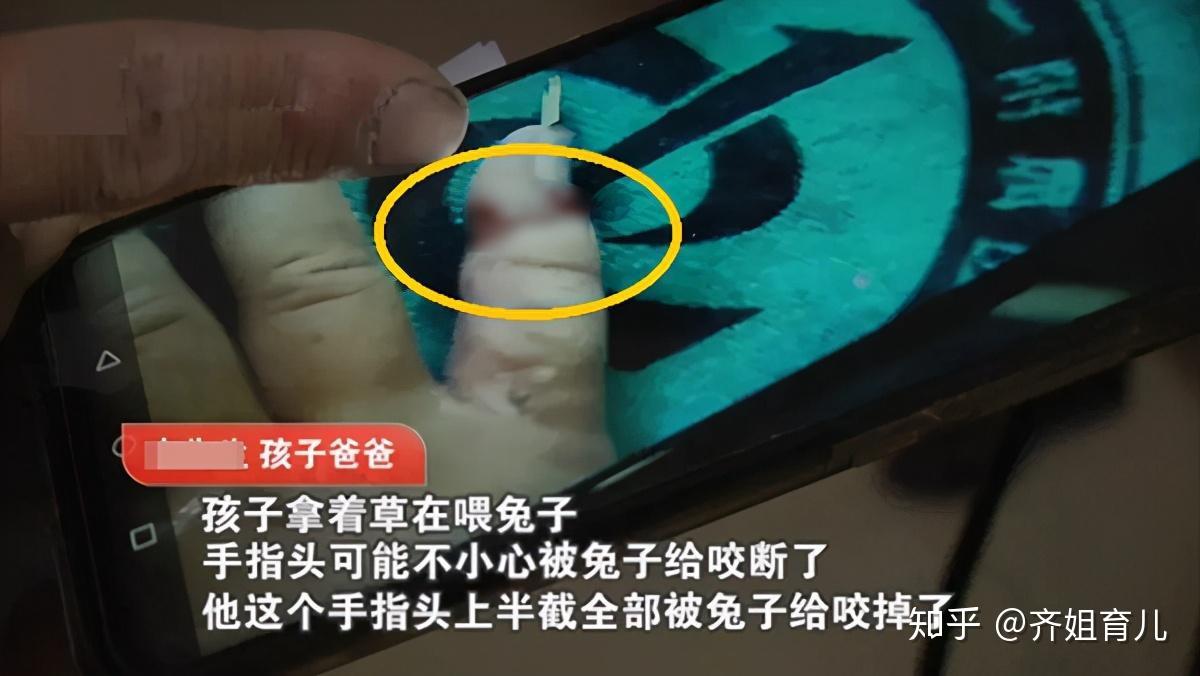 1岁男童喂兔子一根手指被生生咬断家里有娃养宠物要当心