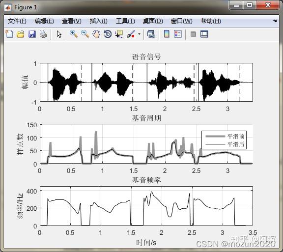 MATLAB语音信号分析与合成(第二版)》:第8章 基音周期的估算方法 - 知乎