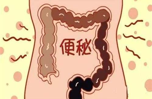 针对长期便秘的微创治疗