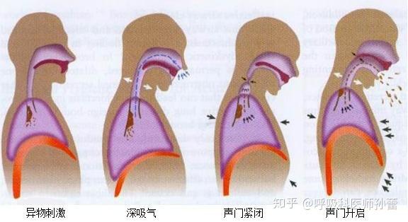 人体出痰别急着吃药,搞清痰的性质很重要 - 知乎