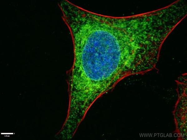 免疫荧光（IF）常用细胞器标记物指南！ - 知乎