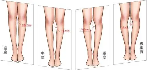 事实证明女生合不拢腿不会更快乐