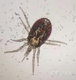 革螨鼠螨吸血螨 柏氏禽刺螨 人畜共患螨 - 知乎