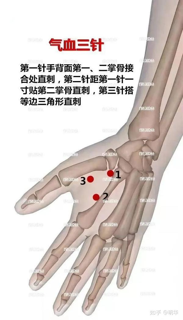 气血三针:温补气血,通调三焦之气 - 知乎