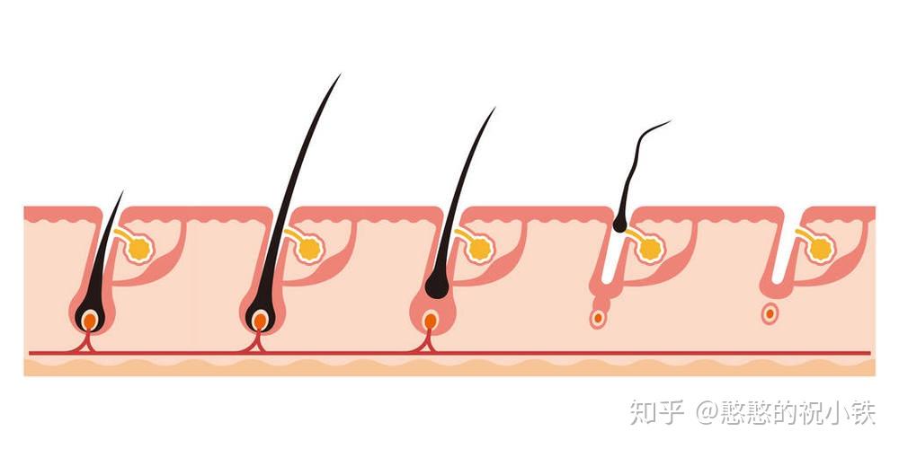 家用脱毛仪是否真的可以实现永久脱毛呢? - 知乎